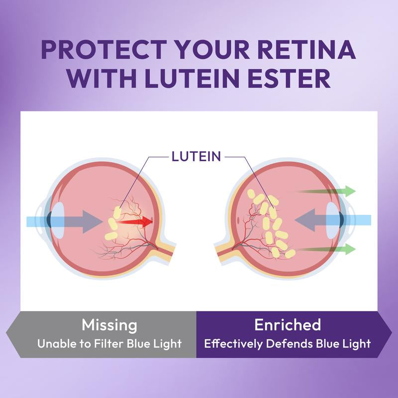 【Eye Care Essential】Lotfly Lutein Ester Gummies | Blueberry Flavor, Individually Packed | Lutein & Zeaxanthin for Clear Vision & Eye Health – 50 Gummies