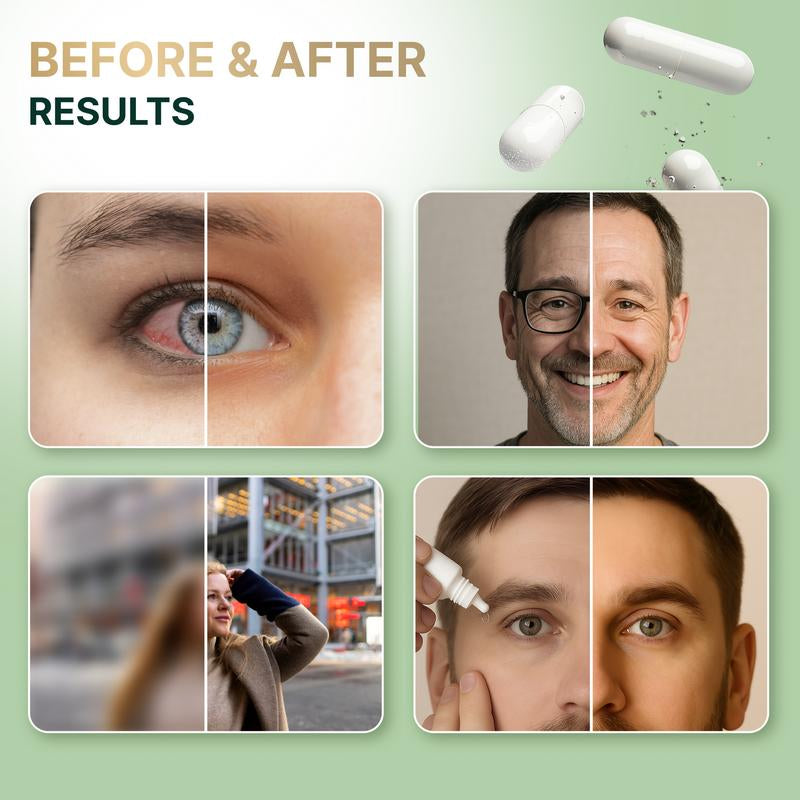 Novalab+ Eye Health & Vision Support – 30-Day Formula with Lutein, Zeaxanthin, Bilberry, Vitamins, Minerals & Antioxidants